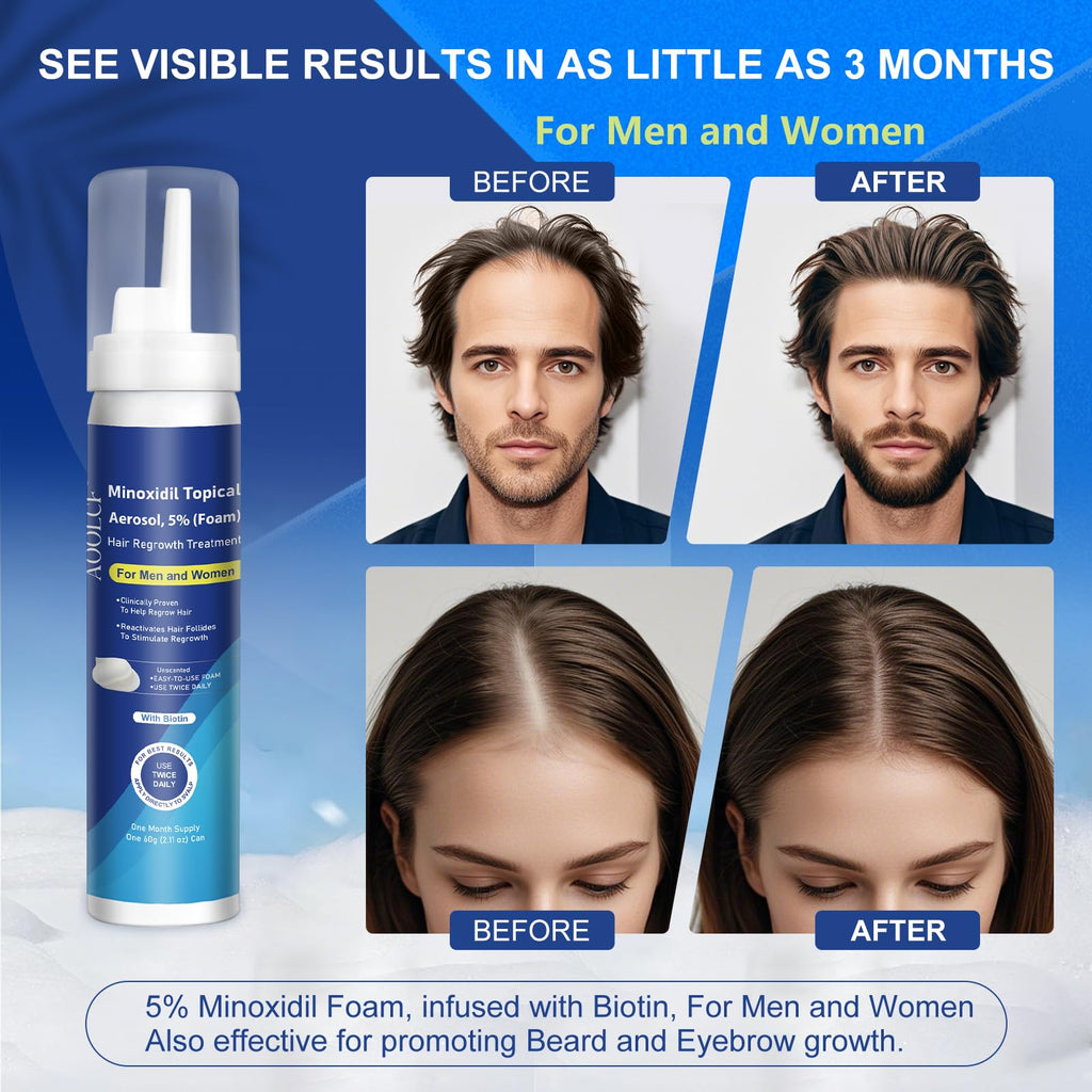 AOOLCF biotin infused minoxidil foam aerosol dispenser