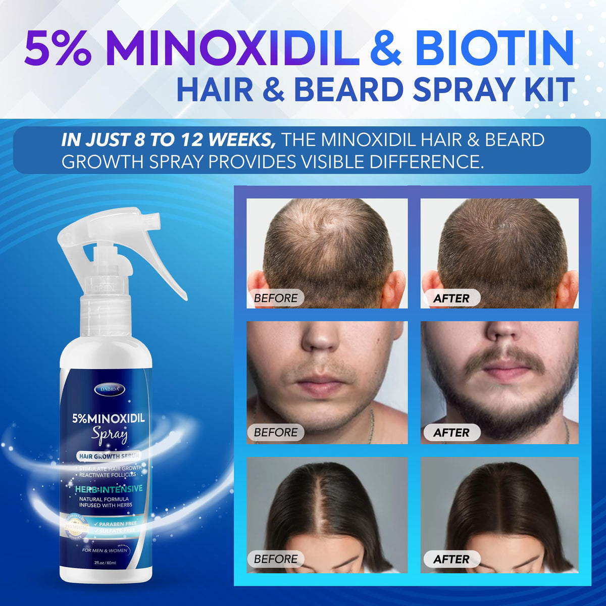 DABIDA minoxidil topical spray nozzle detail for targeted scalp and beard hair growth