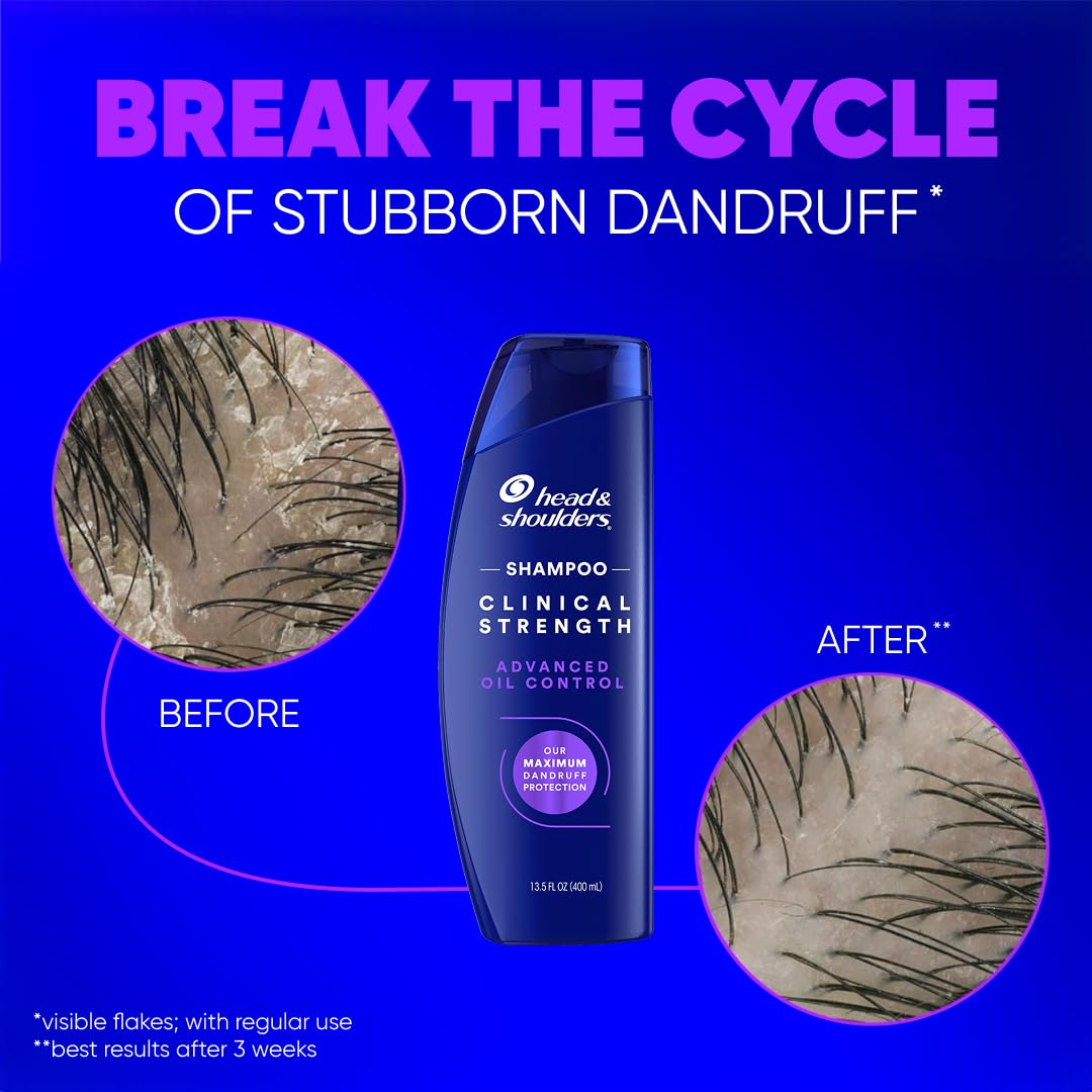 Advanced oil control citrus infused anti dandruff shampoo for severe flaking.