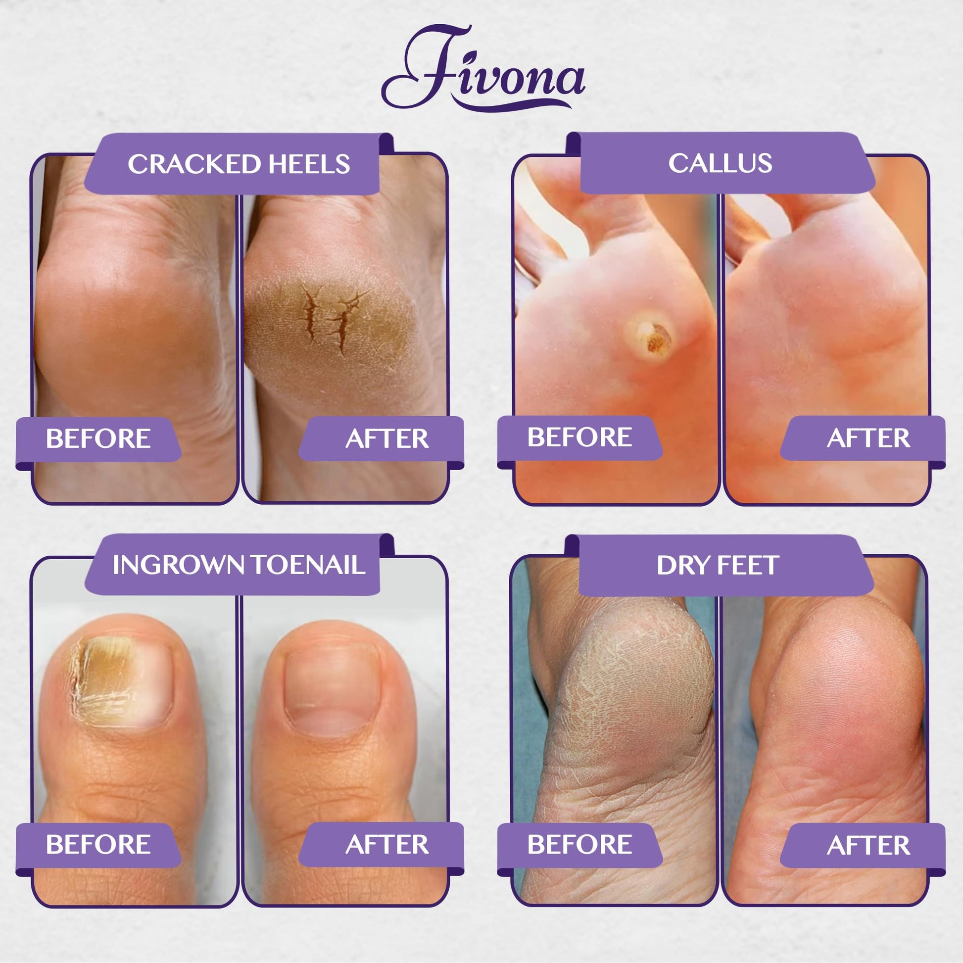 Graphic showcasing the calming effects of Fivona lavender and Epsom salt soak
