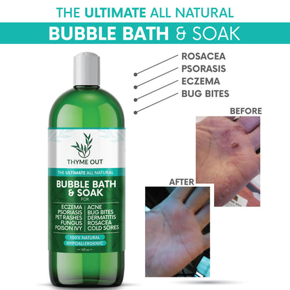 Thyme Out eczema bath soak 16 fluid ounces bottle