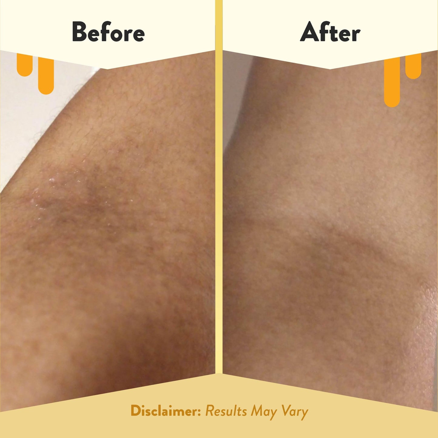 Eczema Honey nourishing bath soak for sensitive skin lifestyle setting