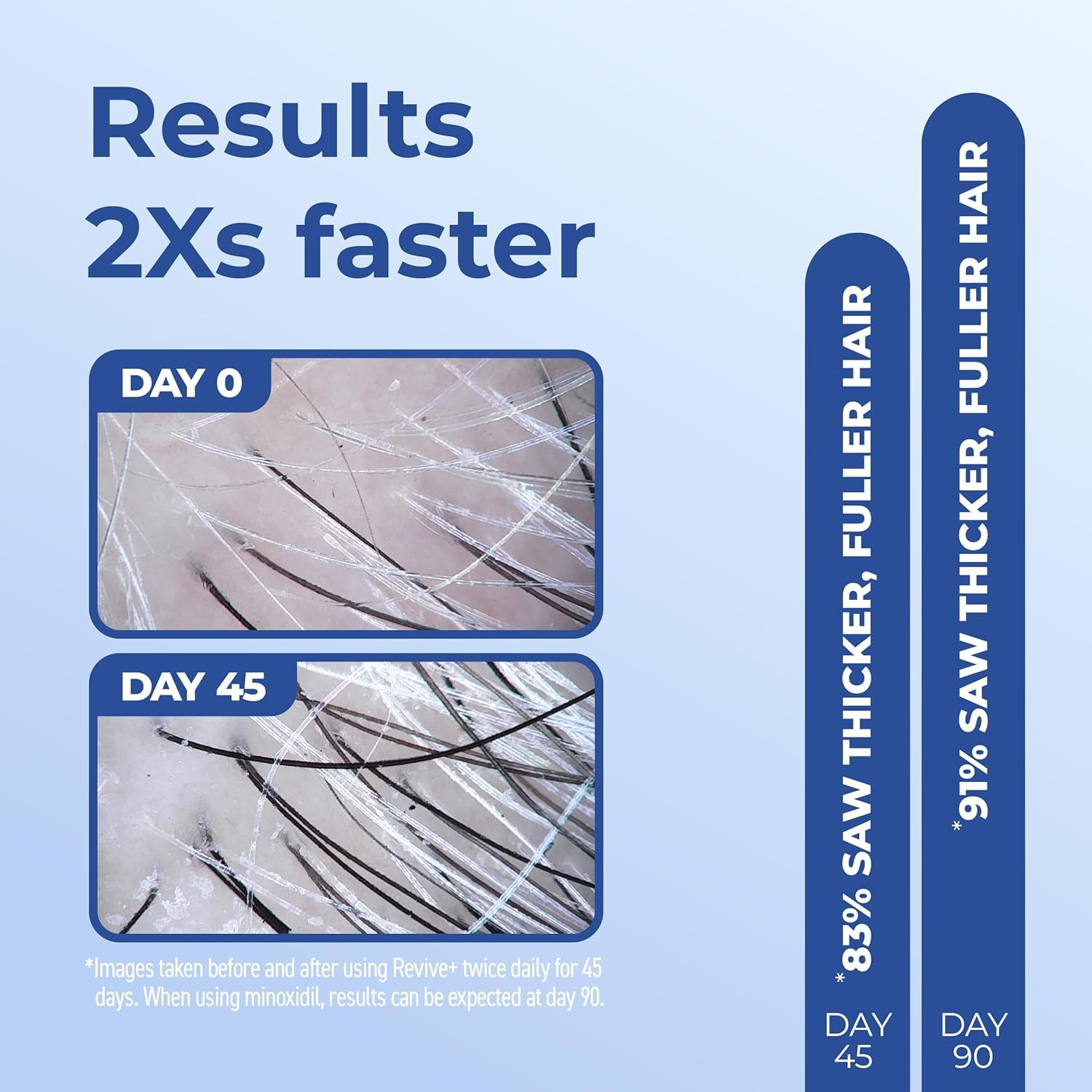 BosleyMD premium USA imported hair density foam for thinning crown care