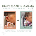 Small batch tallow balm for dry skin and eczema