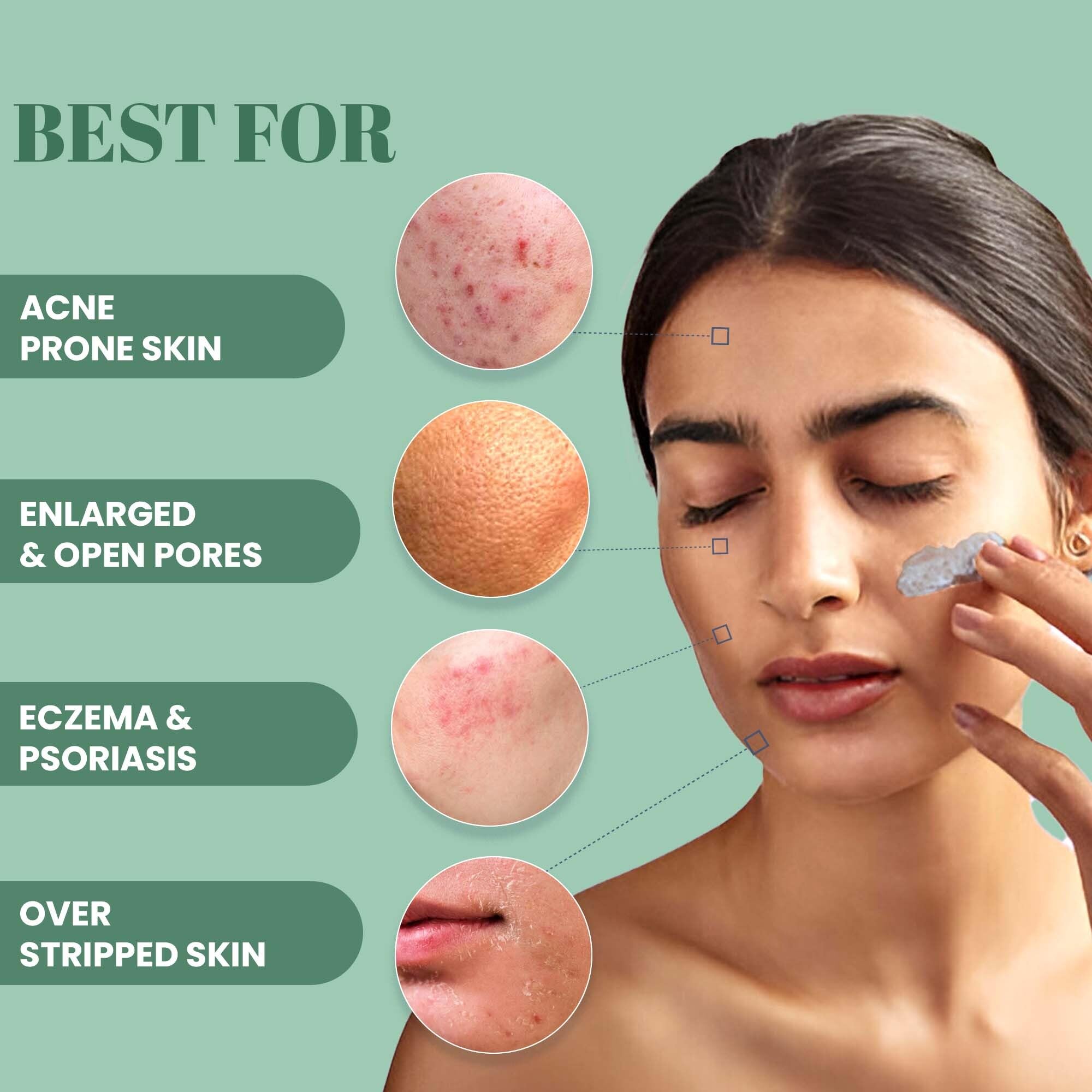 Wild Oak clay mask benefits for acne and pigmentation