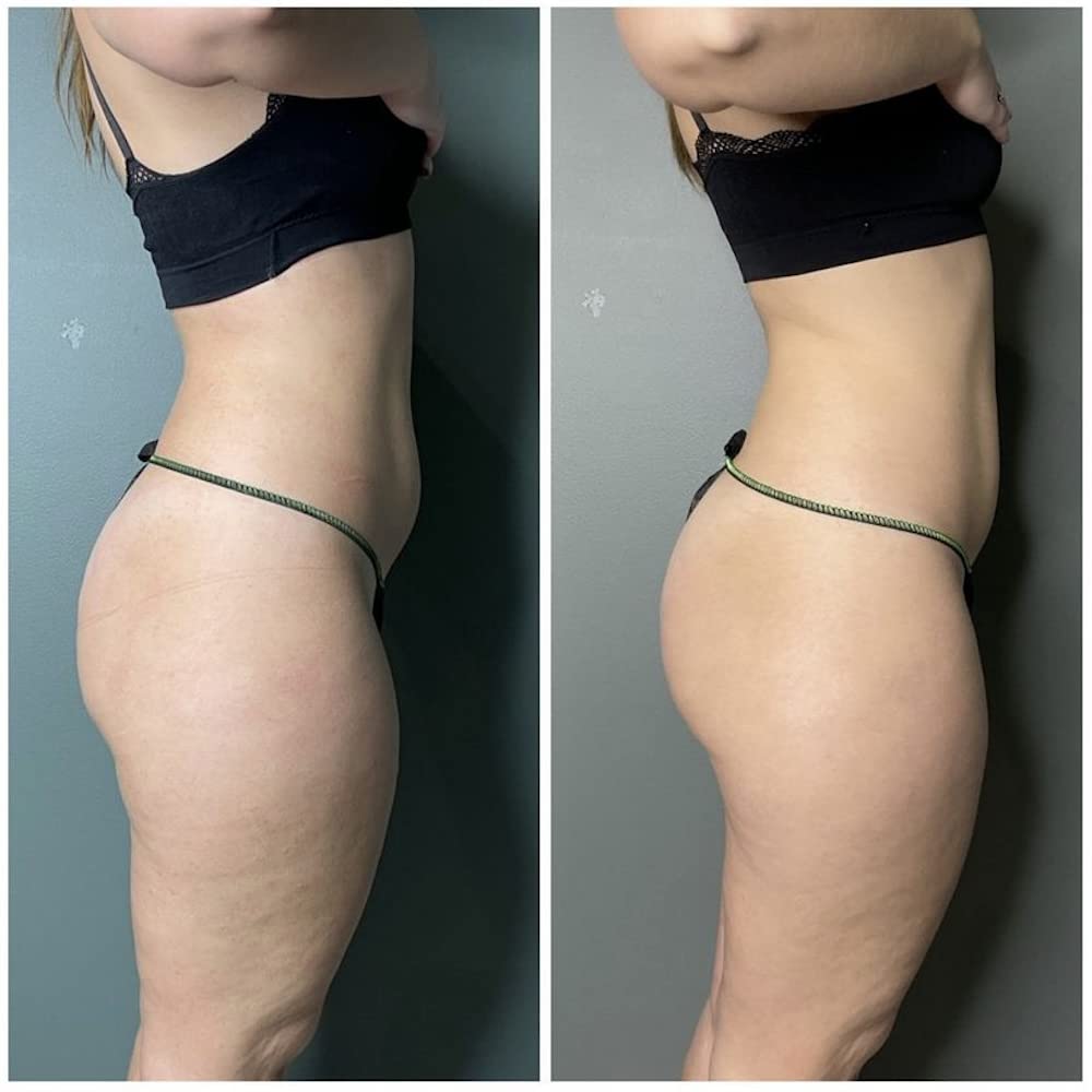 Guam marine clay body contouring mud with black tourmaline for advanced microcirculation benefits