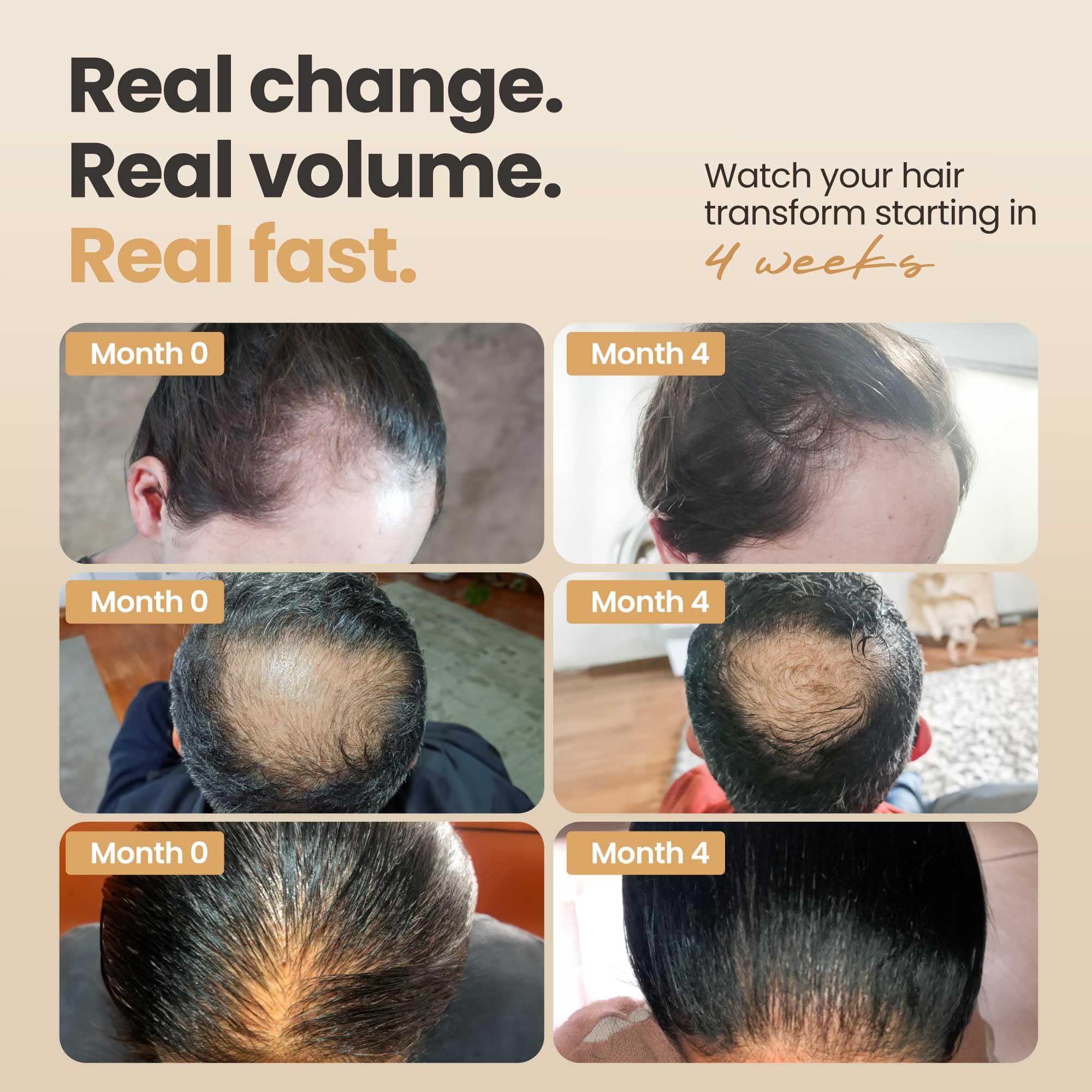 Vitasei Hair Tonic spray bottle highlighting Capilia Longa and wild olive stem cells.