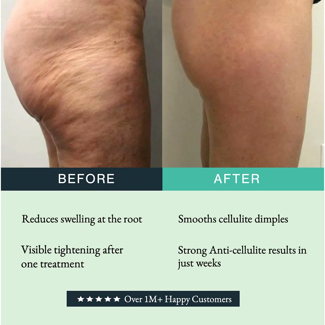 Authentic imported Guam lymphatic drainage mud wrap for leg swelling and water retention.