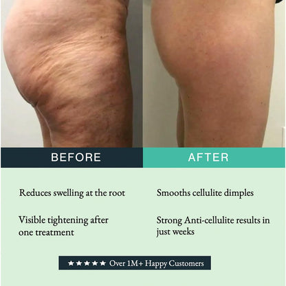 Authentic imported Guam lymphatic drainage mud wrap for leg swelling and water retention.