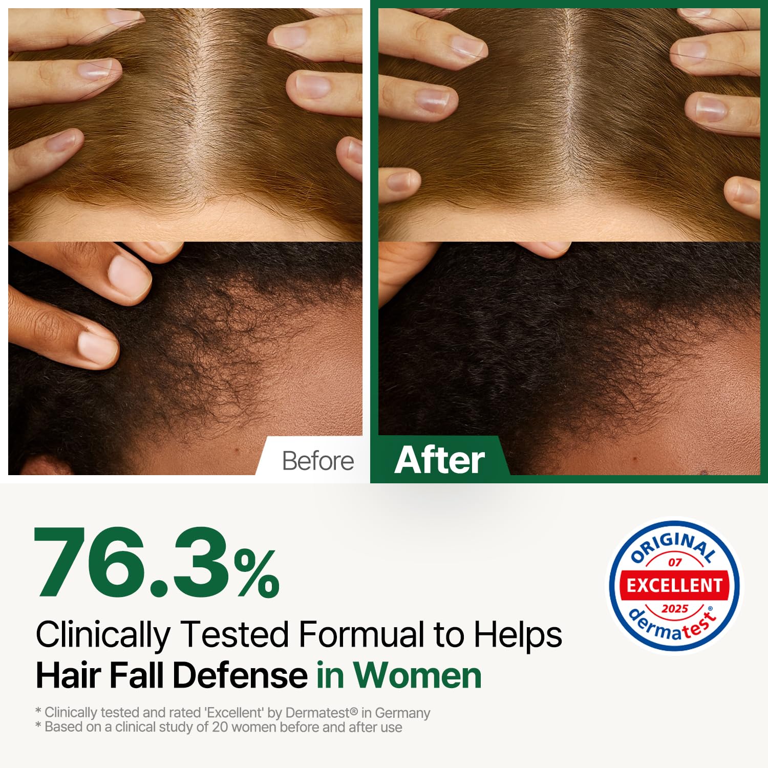 ROOTON women hair loss tonic spray nozzle detail for precise application