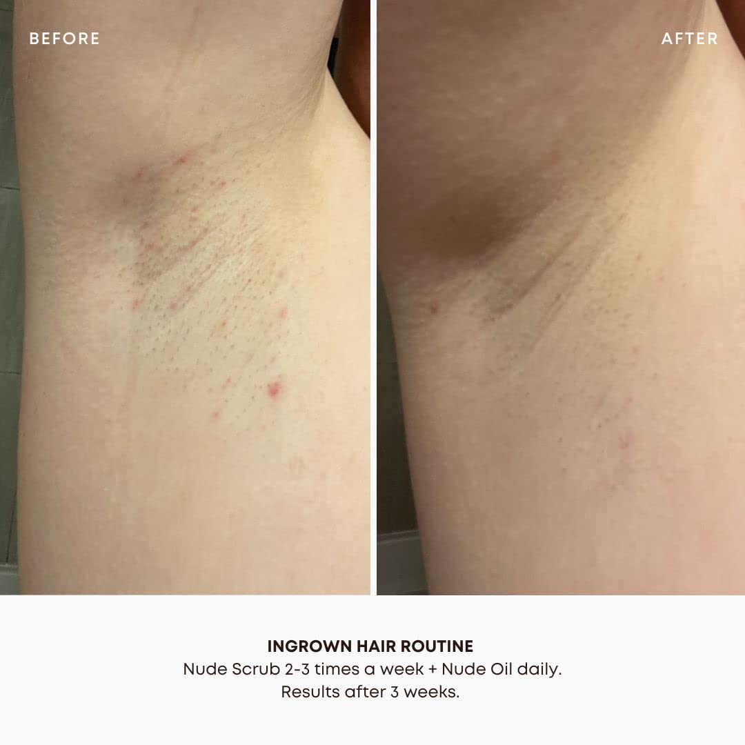 Applying Bushbalm Nude treatment oil dropper to sensitive underarm skin