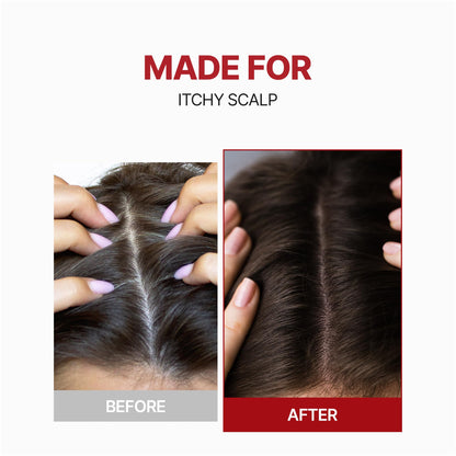 Kundal vitamin b3 and tea tree oil hair spray premium packaging visual