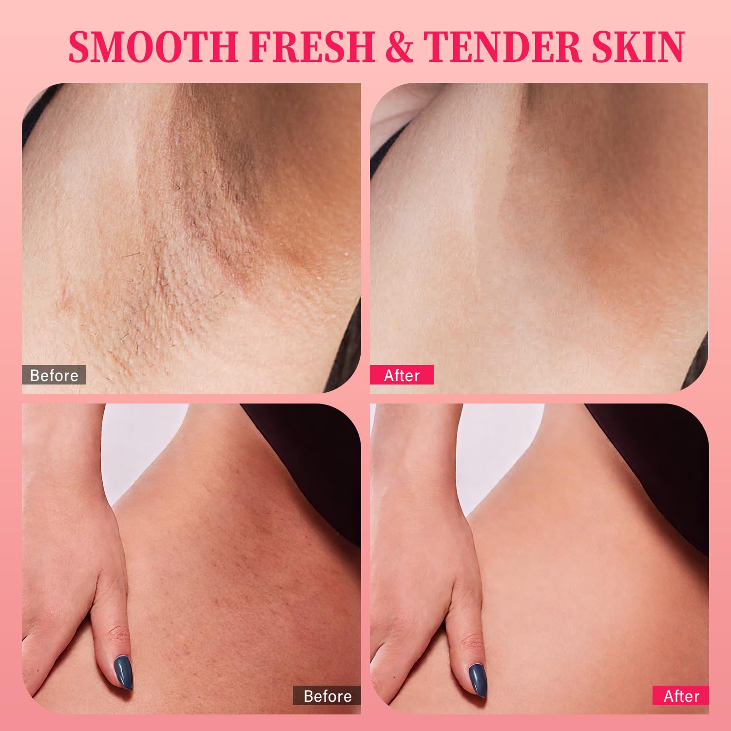 Ulluxe bikini line and underarm bump eraser product details