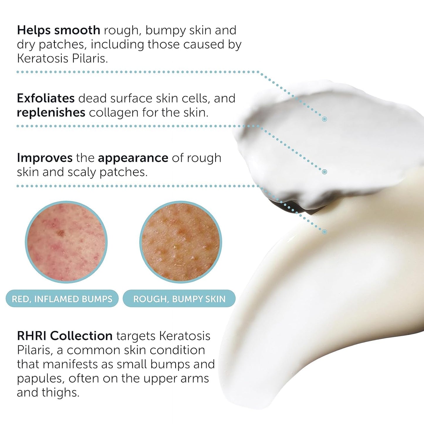 Close-up of the 10% AHA Keratosis Pilaris Treatment packaging detailing the exfoliating benefits for rough skin.