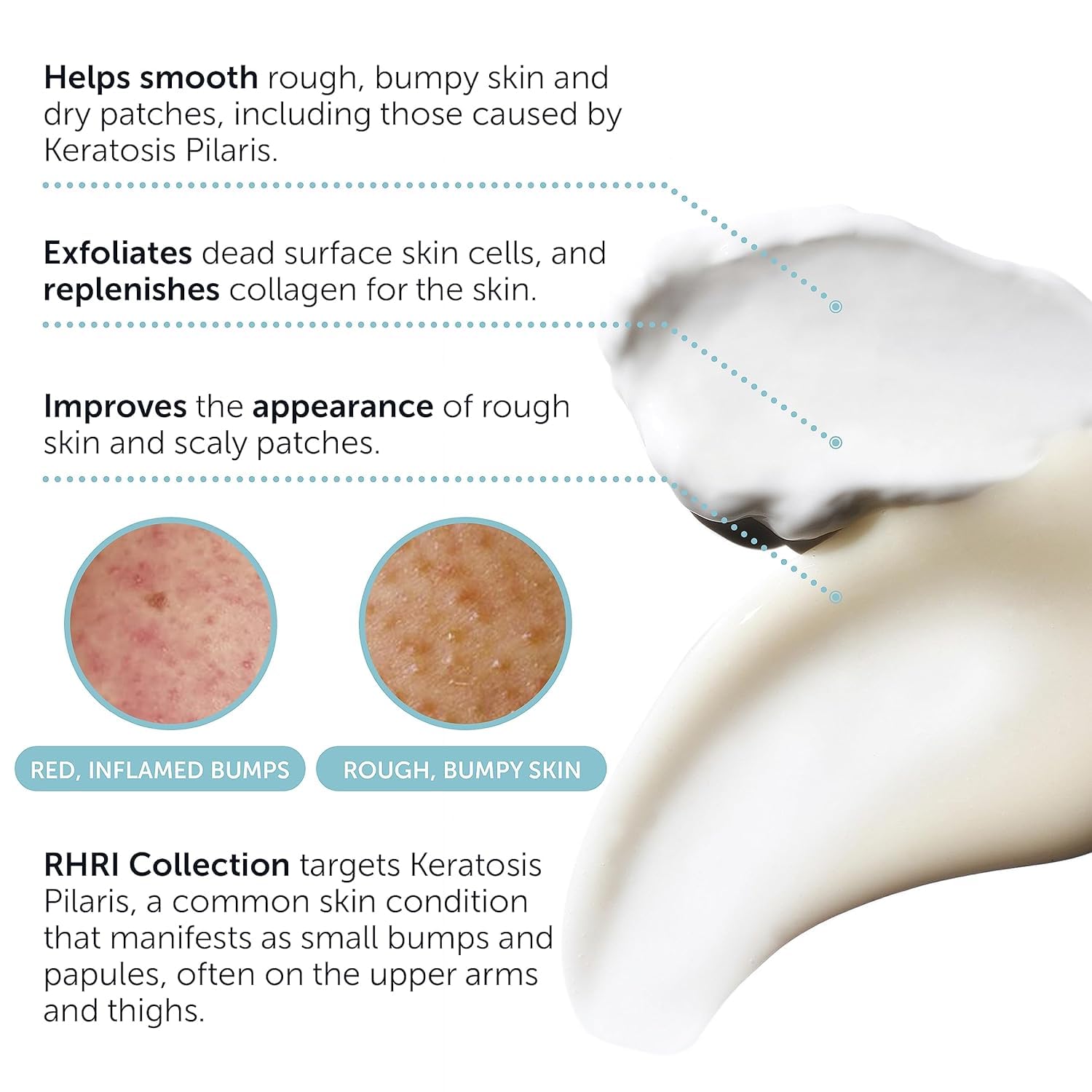 Close-up of the 10% AHA Keratosis Pilaris Treatment packaging detailing the exfoliating benefits for rough skin.