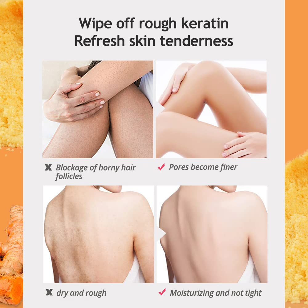Liyalan Turmeric Body Scrub usage on elbows and knees