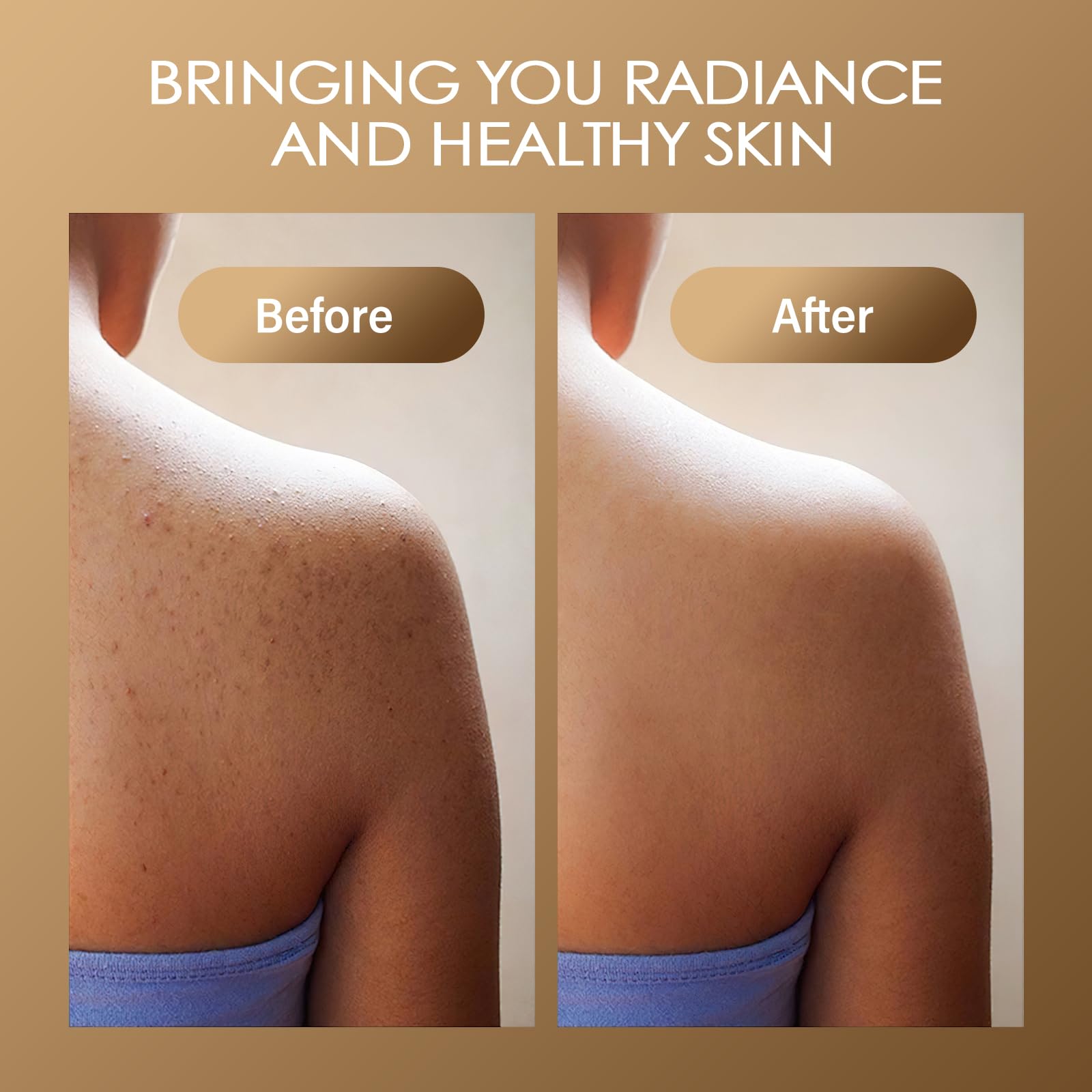 MOSRROU dead skin remover scrub alongside the included applicator sponge and loofah accessory