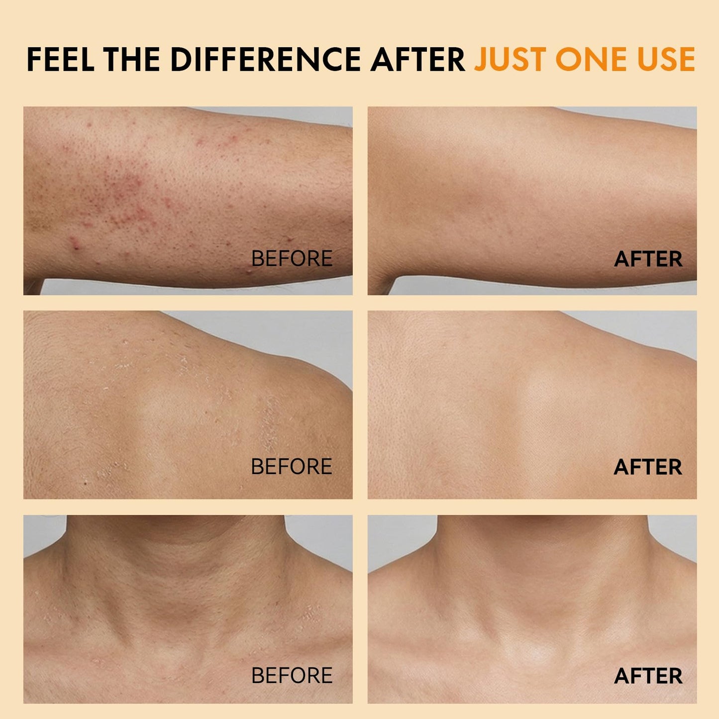 Eelhoe skin smoothing spray package contents featuring the dual-textured physical exfoliation sponge