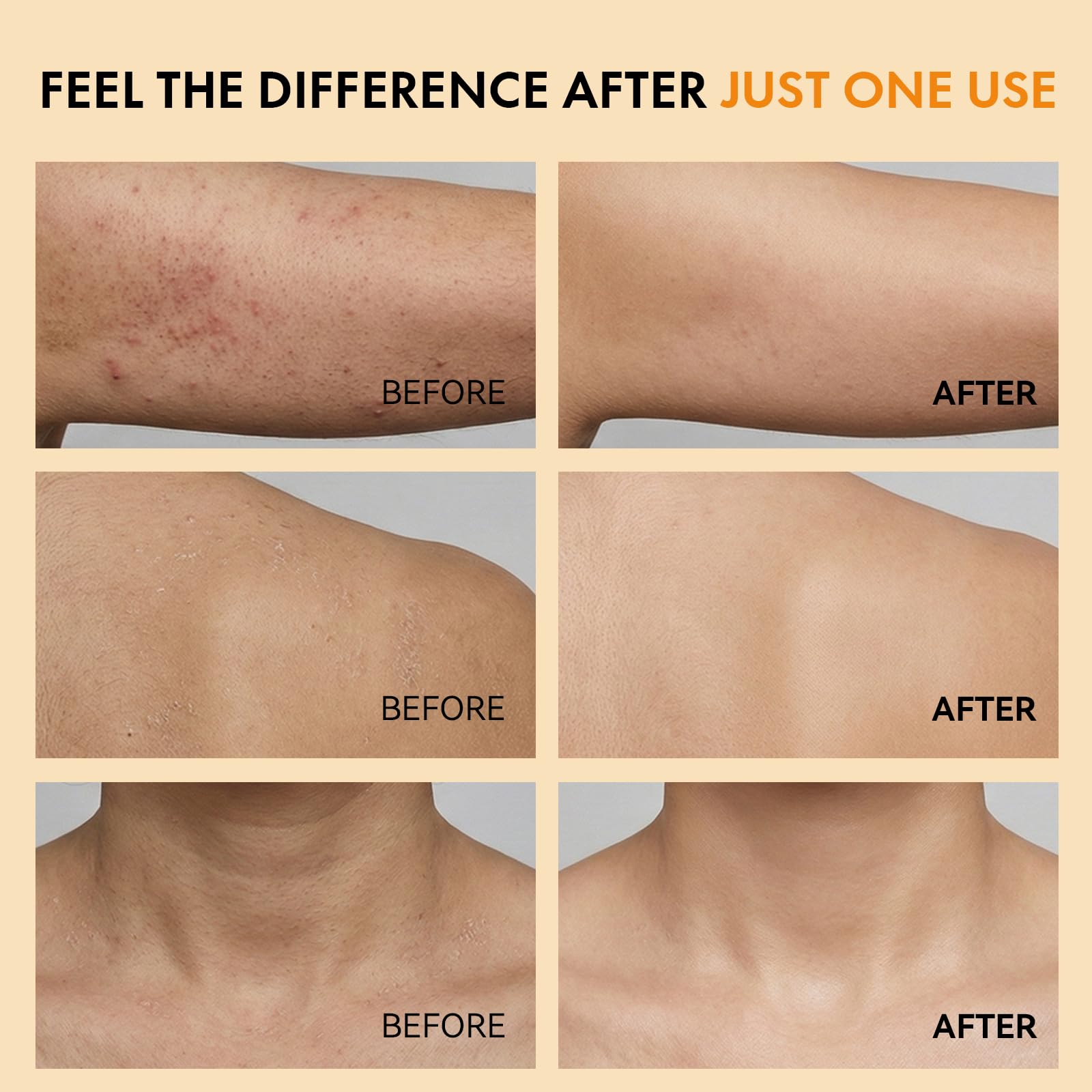 Eelhoe skin smoothing spray package contents featuring the dual-textured physical exfoliation sponge