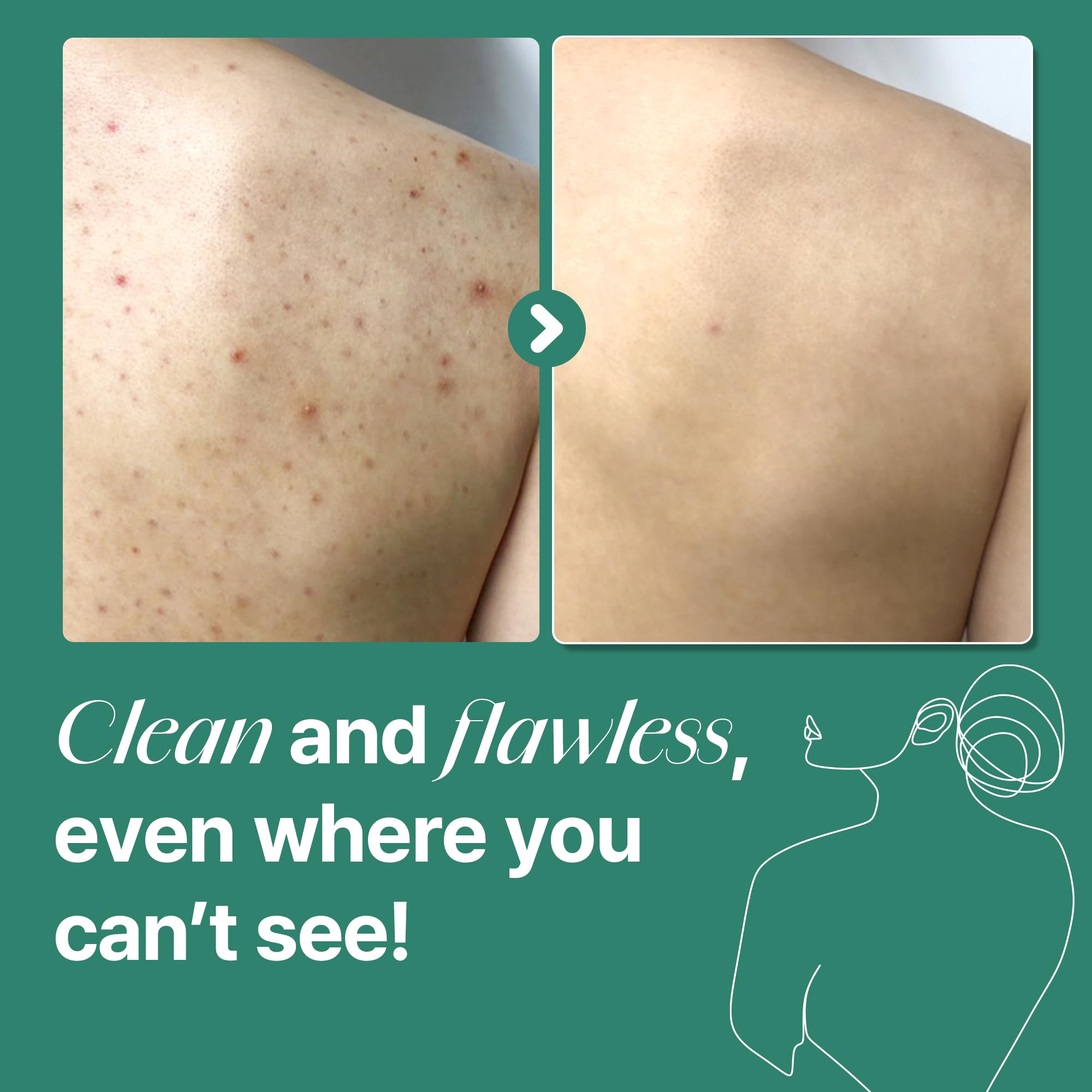 Application of Some By Mi miracle body cleanser on skin
