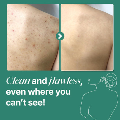 Application of Some By Mi miracle body cleanser on skin
