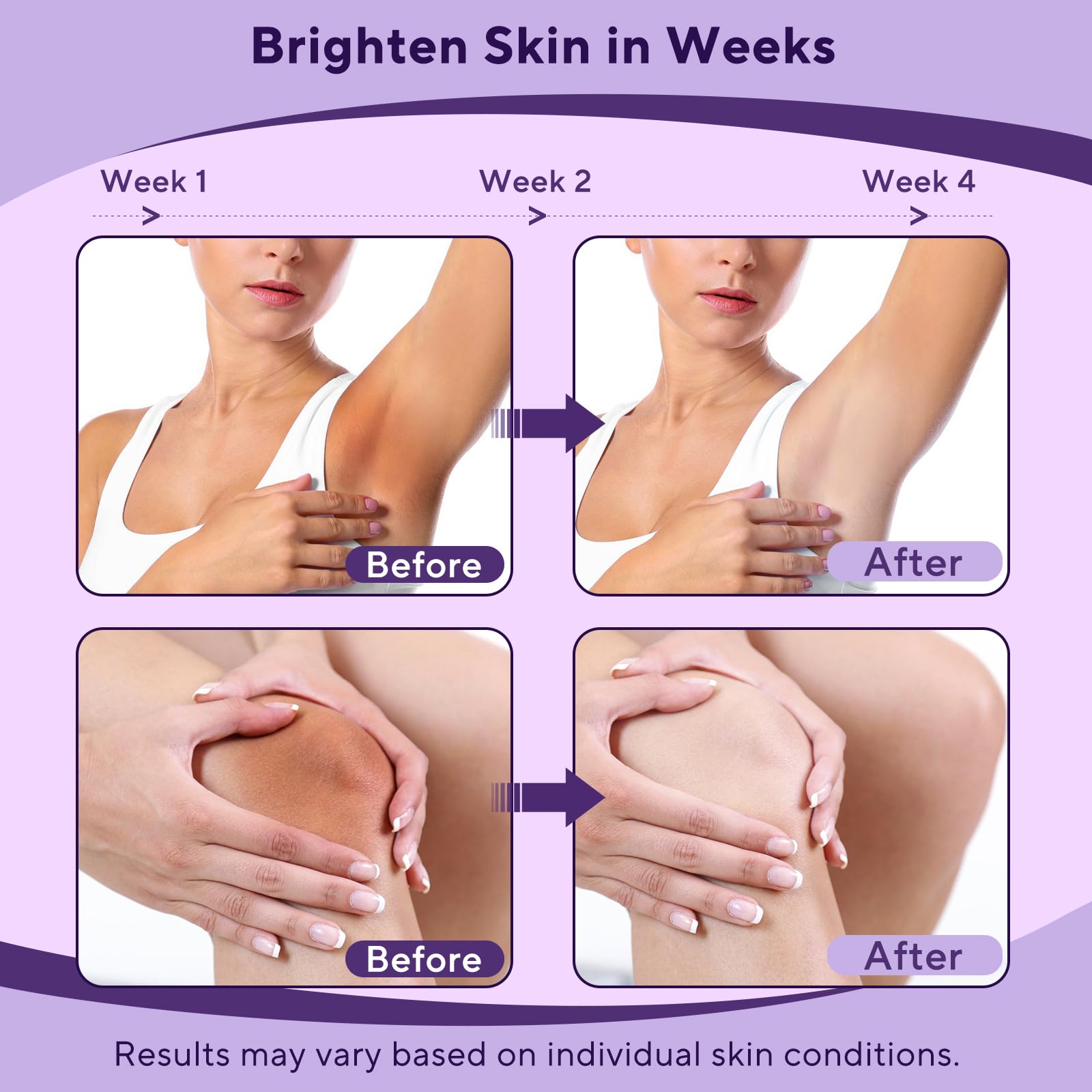 Geafaw intimate skin lightening formula with vitamin c for dark spot correction.