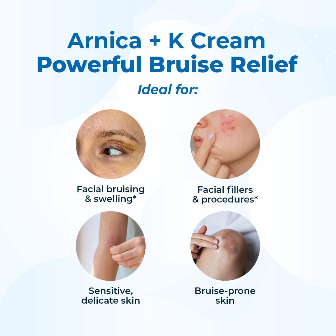 VitaMedica under eye bruise healing topical cream product shot