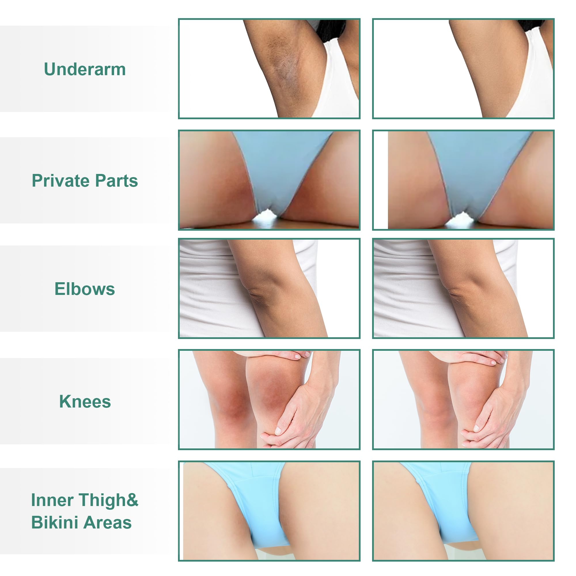 Texture shot of Vcetree dark spot remover cream for knees and elbows