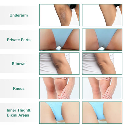 Texture shot of Vcetree dark spot remover cream for knees and elbows
