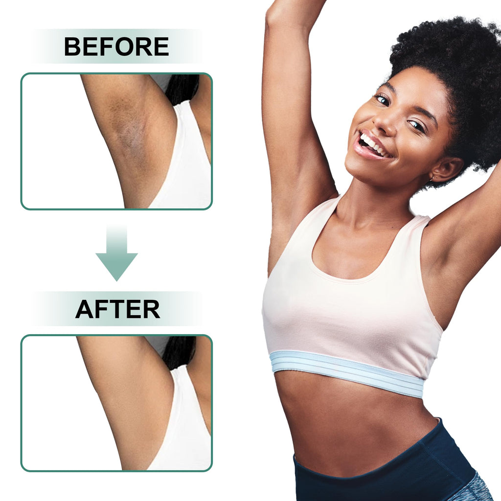 Vcetree underarm lightening cream open cap