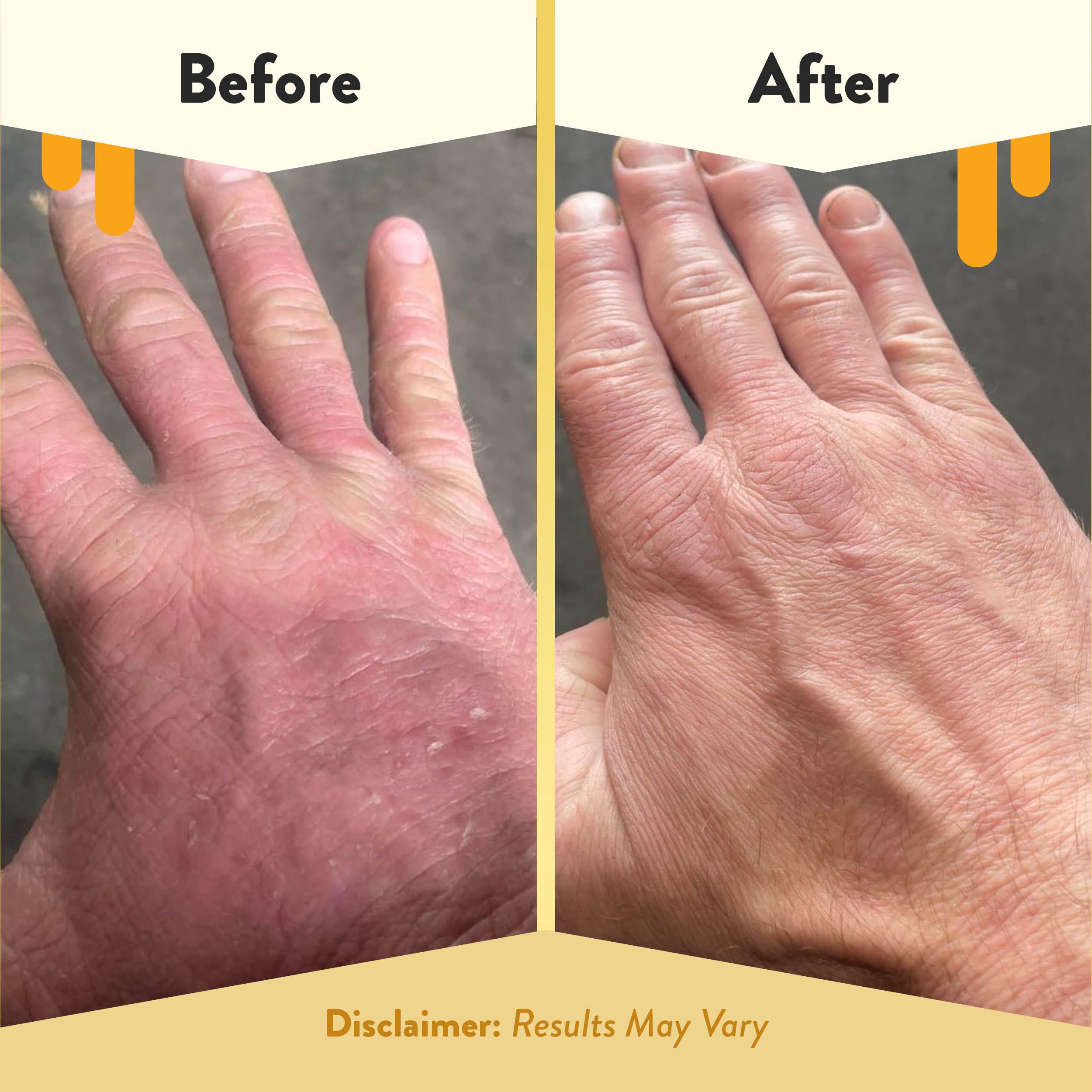 Lifestyle shot of Eczema Honey foaming soap in bathroom setting