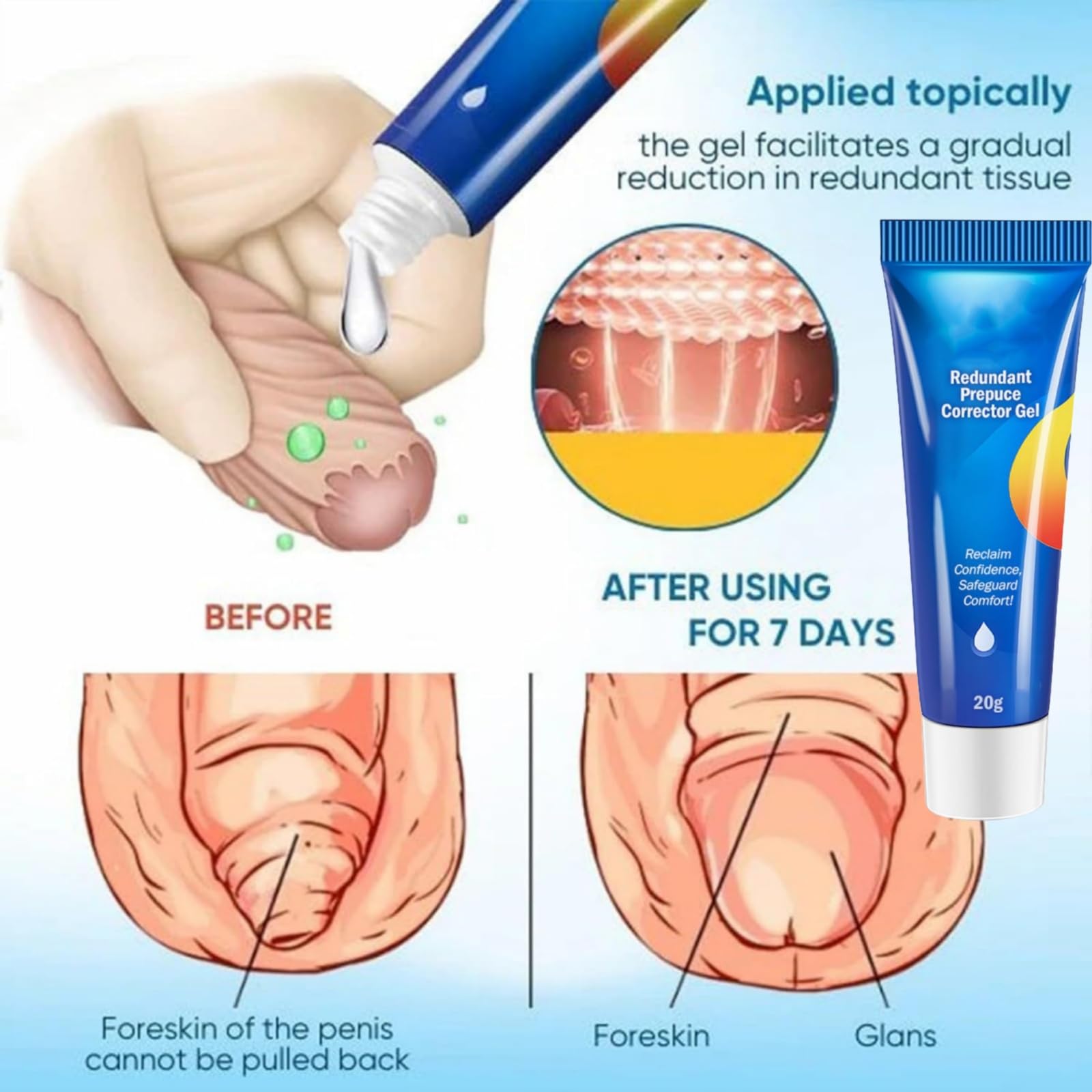 Zytuuob excessive foreskin care gel topical application bottle