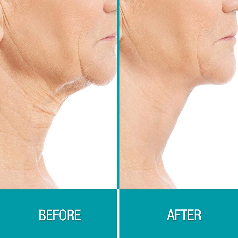 Dermactin Crepe Away Cream Body Souffle for neck chest arms and legs