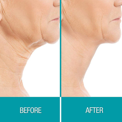 Dermactin Crepe Away Cream Body Souffle for neck chest arms and legs