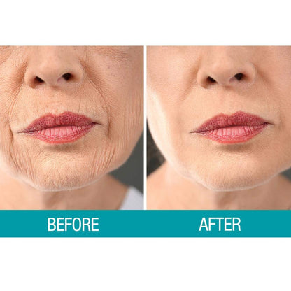 Dermactin TS pharmacist recommended crepey skin treatment product back ingredients
