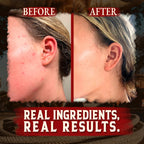 Person applying organic grass-fed beef tallow moisturizer to hand