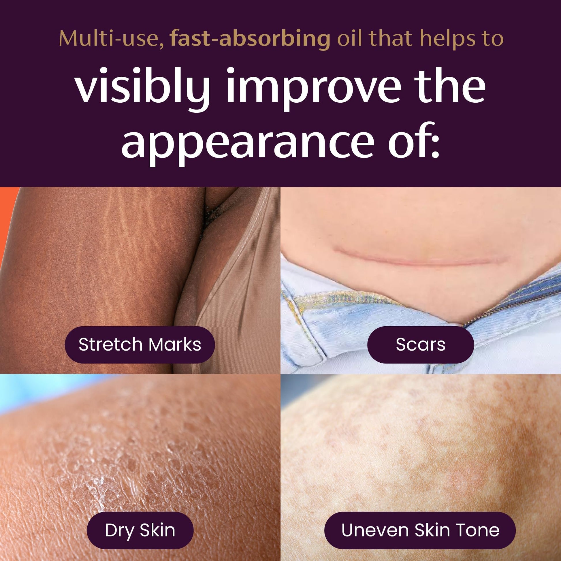 Mederma Quick Dry Oil branding and professional skincare label