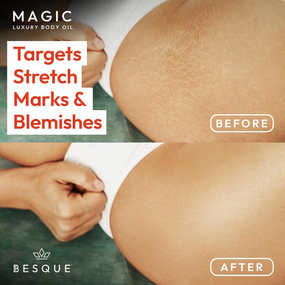 Besque Magic Body Oil bottle side profile and size