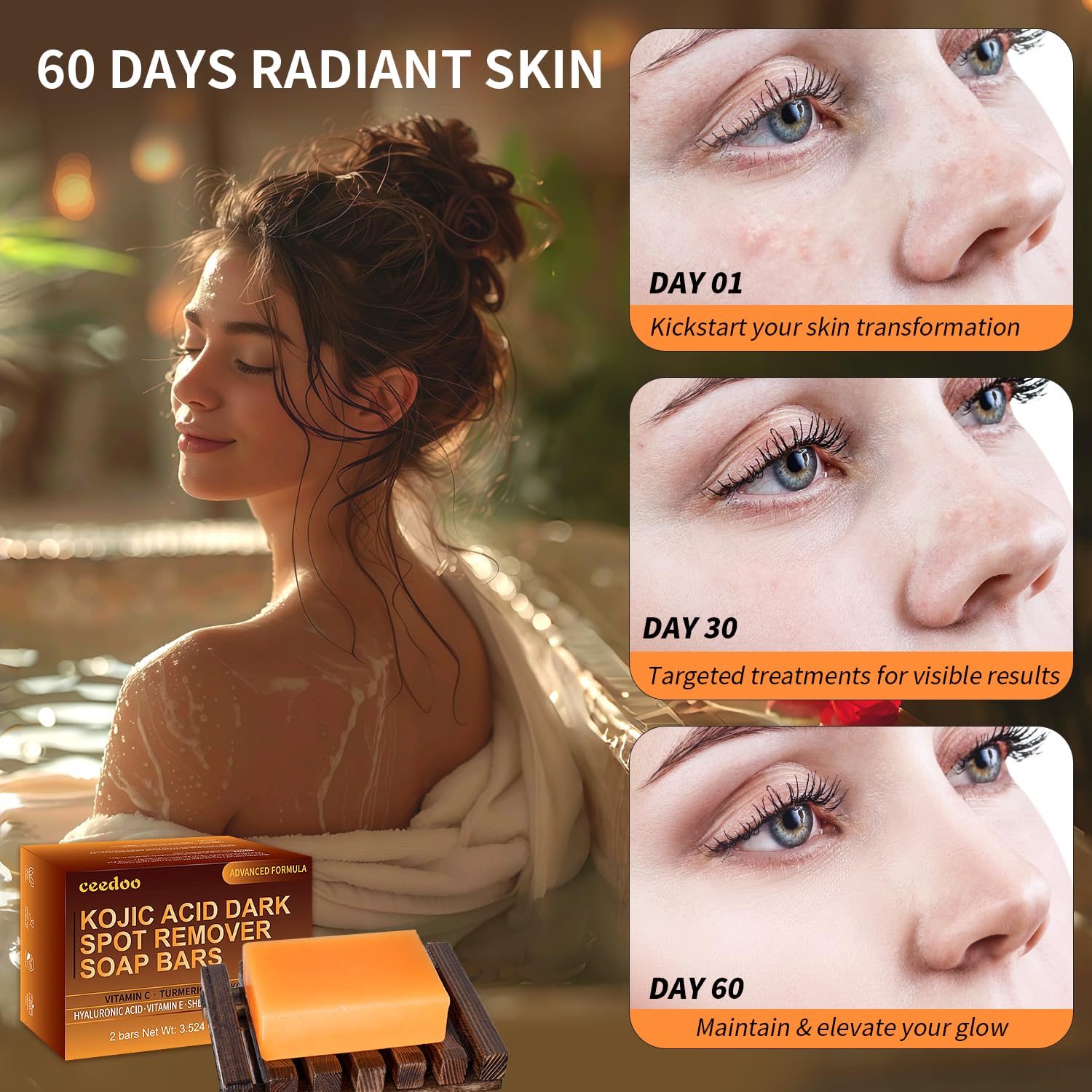 Authentic Ceedoo imported daily cleansing bar with hyaluronic acid