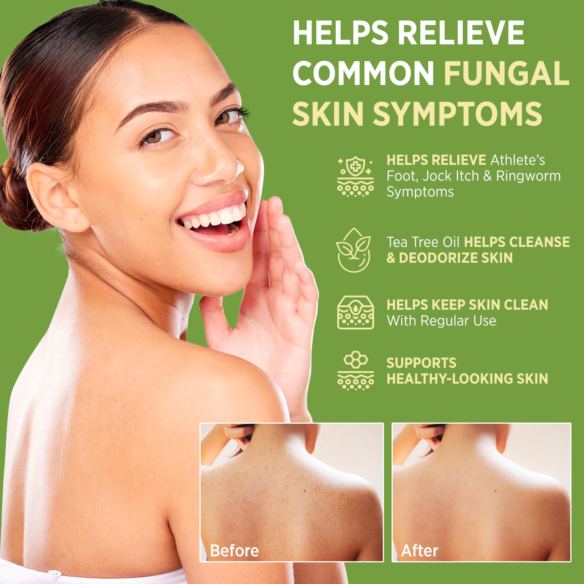 Roycederm Athlete Foot Treatment soap highlighting daily defense for active and sweat-prone skin.