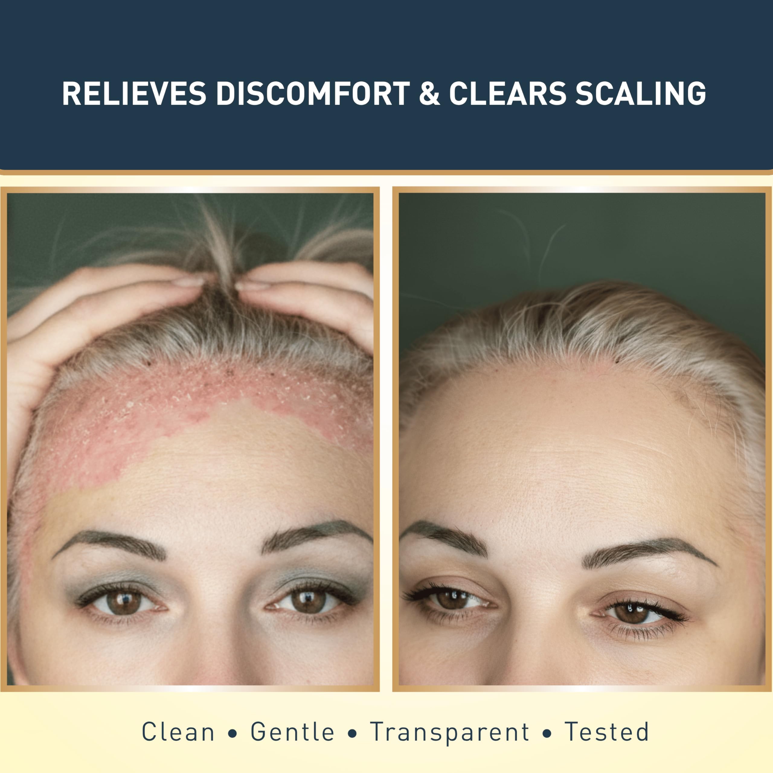 Jericho French-milled sulfur soap bars for clearing blackheads