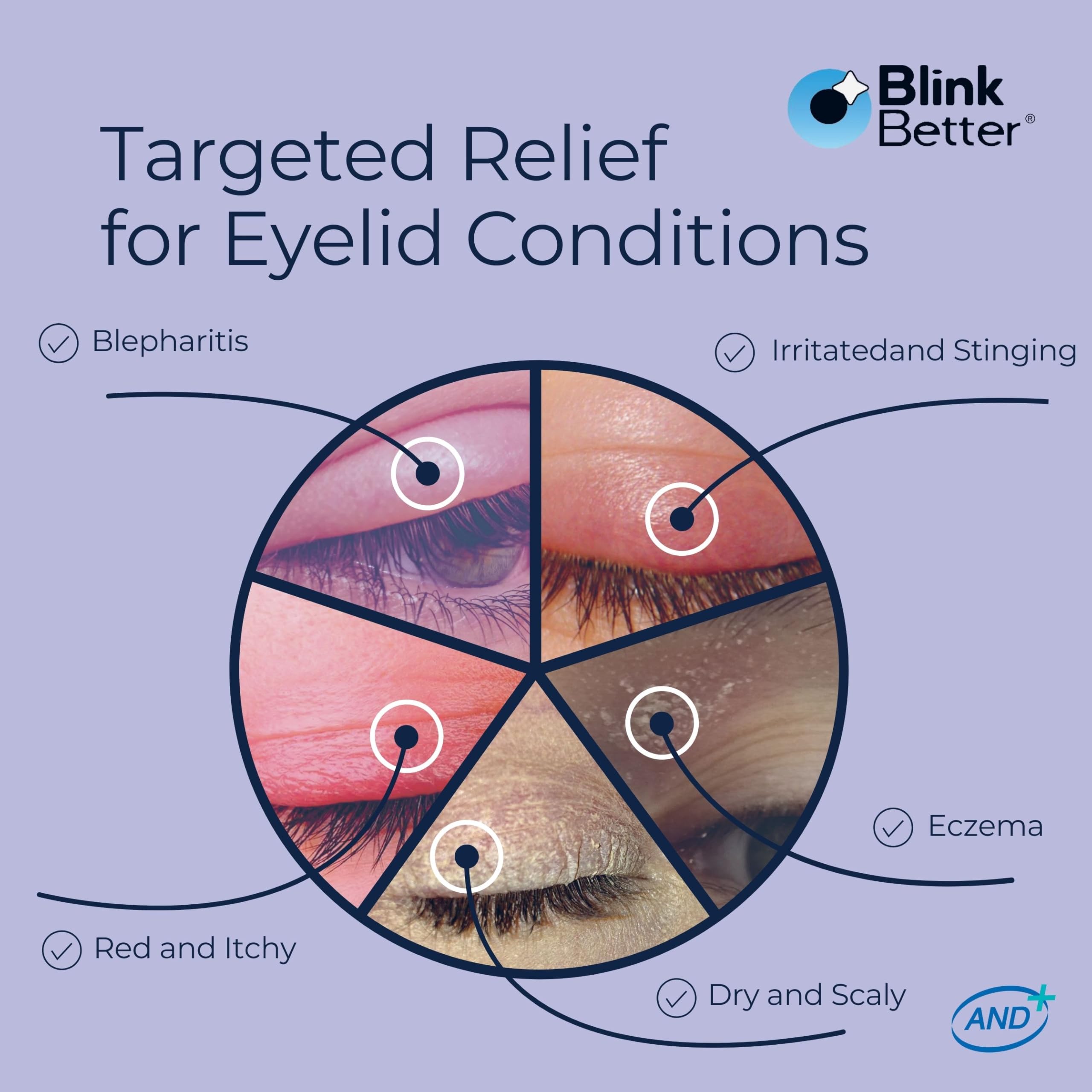 BlinkBetter BetterLids Eyelid Ointment texture close up for sensitive skin care