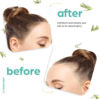 Side view of Artnaturals hair regrowth set highlighting the coconut and olive oil infusion.