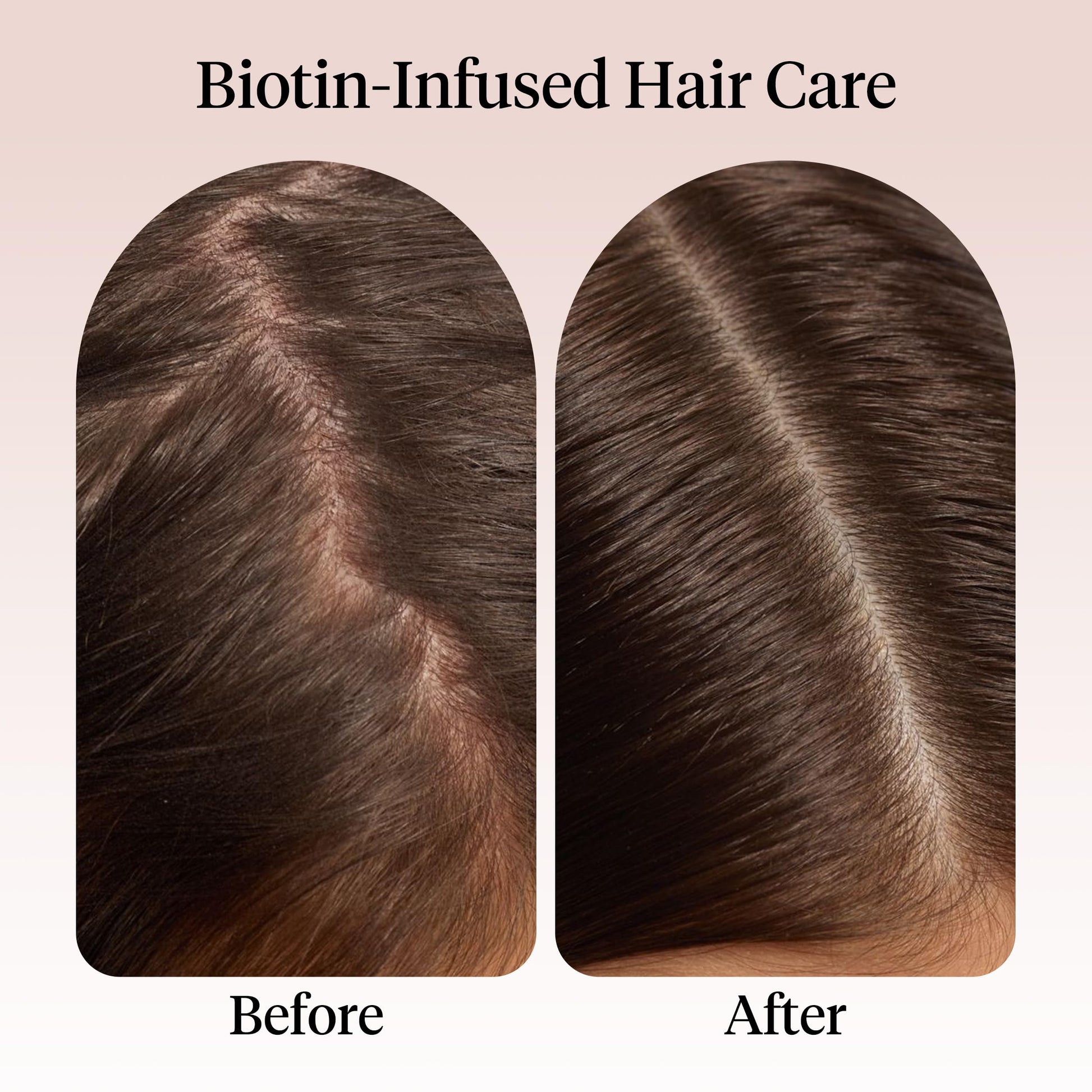 Kitsch plant-based hair growth oil with castor and jojoba ingredients lifestyle shot