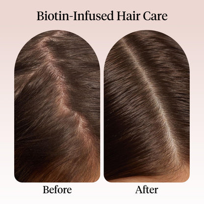 Kitsch plant-based hair growth oil with castor and jojoba ingredients lifestyle shot