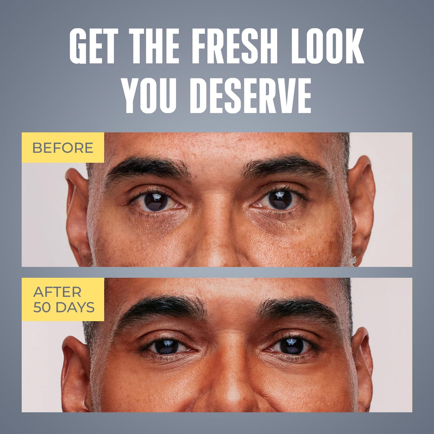 Fragrance free anti wrinkle cream for male dark circles