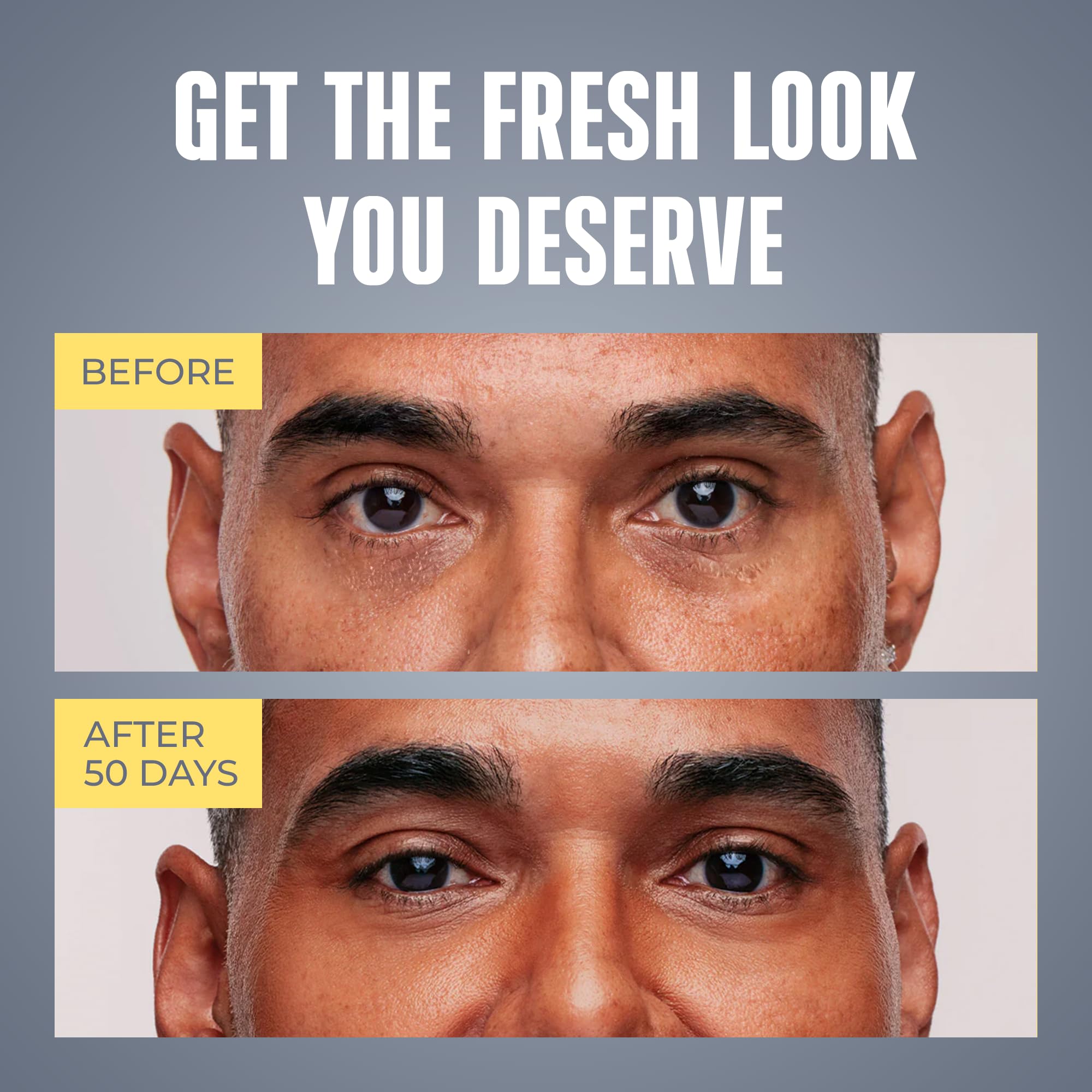 Fragrance free anti wrinkle cream for male dark circles