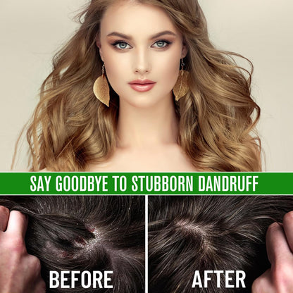 Hair growth oil application on scalp using precision dropper