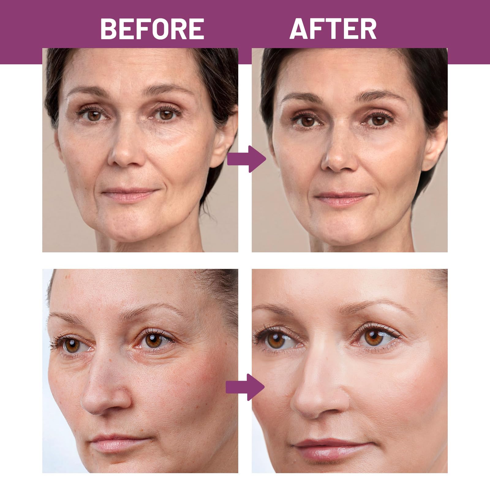 Model applying Azsyyqc multi balm to under eye area