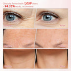 Peunitory firming treatment stick open cap view